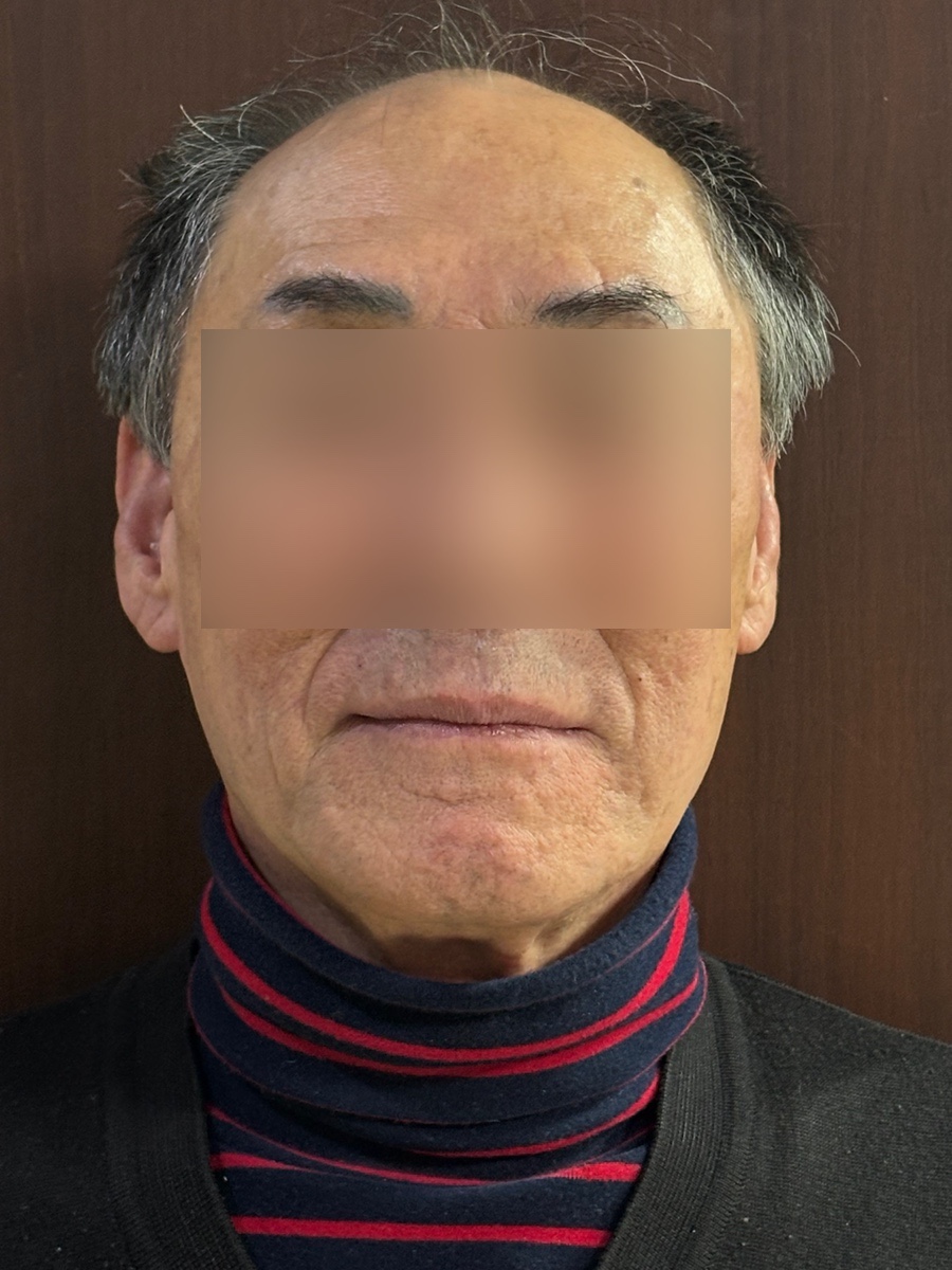 성문치과병원 의료진 쌍문동 임플란트 상담
