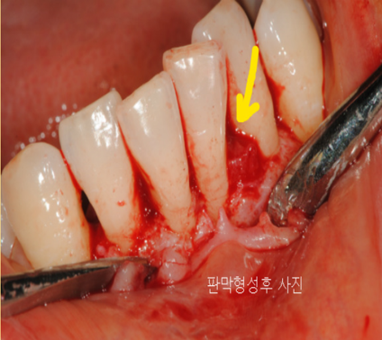 성문치과병원 도봉구 치주질환 치료 상담 공간